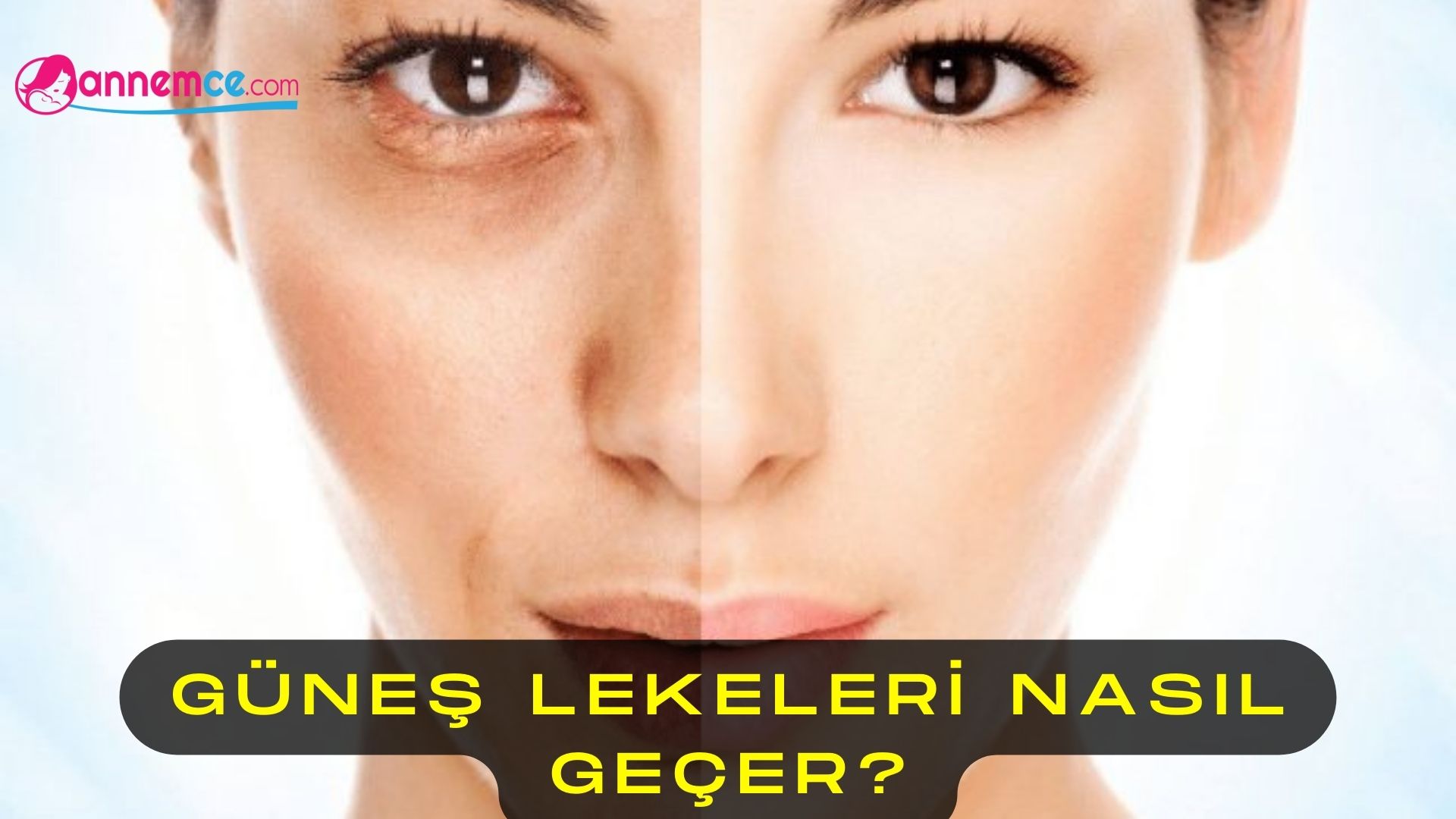 Güneş Lekeleri Nasıl Geçer?